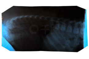 孤立在白色背景上的脊柱 x 射線