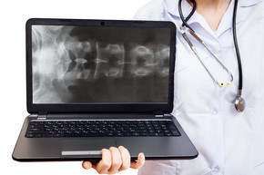 護士拿著電腦筆記本電腦，在白色背景上隔離的屏幕上顯示人體脊柱的 X 射線照片