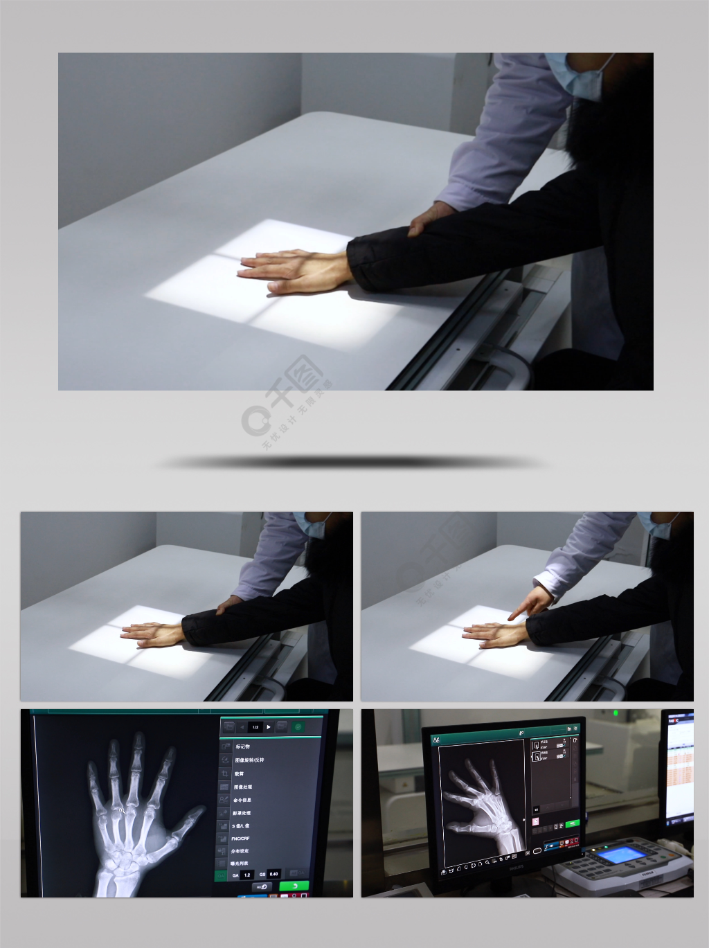 实拍医院影像科做ct手部ct