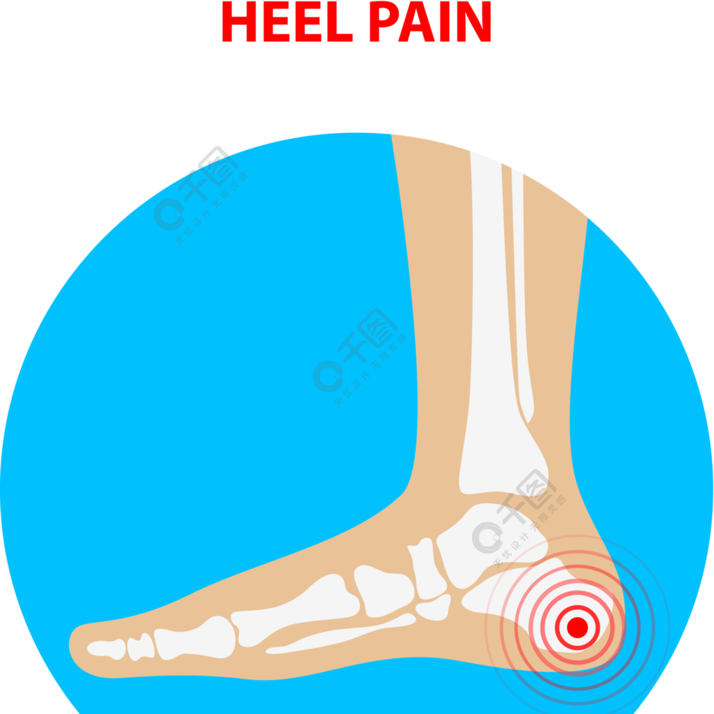 脚跟疼痛人类的脚踝关节图标足部保健向量例证