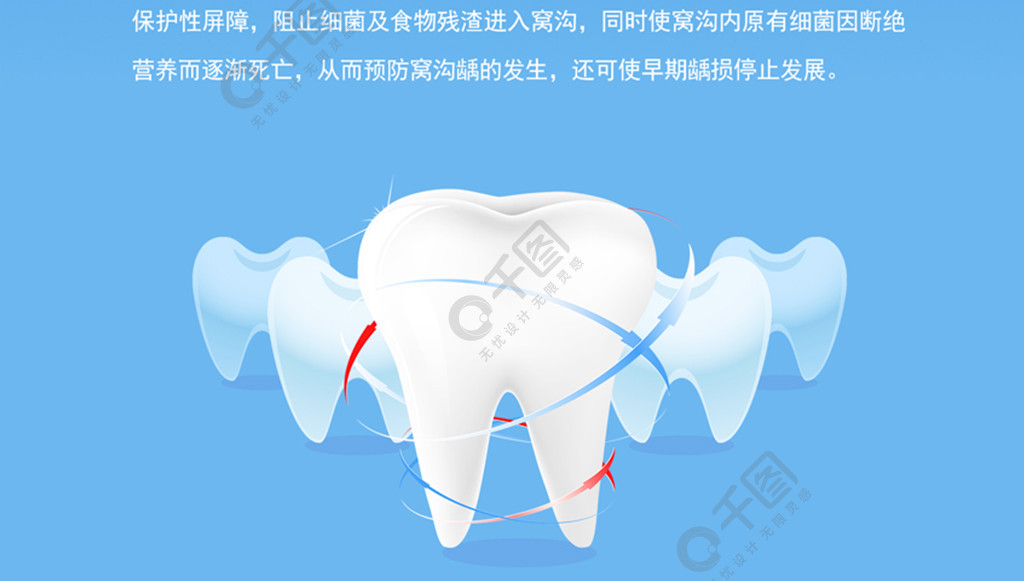 窩溝封閉預防齲齒海報2年前發佈