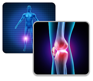 人体膝关节疼痛概念作为骨骼和身体<i>肌</i><i>肉</i>解剖学作为疼痛的腿部损伤或关节炎疾病符号与 3D 插图元素。