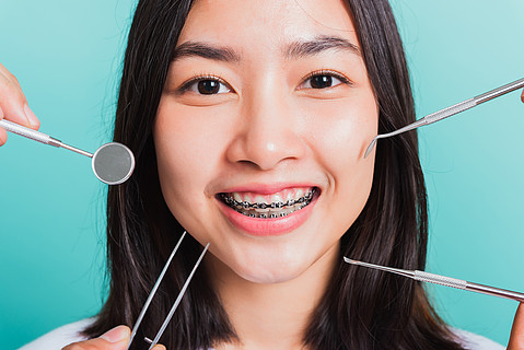 亚洲青少年美丽的年轻女子微笑着牙齿笑着戴牙套,并有用于检查牙齿的