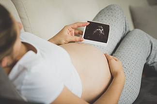 孕妇看<i>超</i><i>声</i>胚胎图像的特写图像