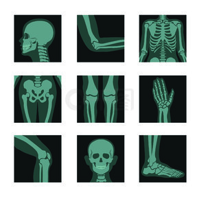 人体的 X 射线照片、头部和手部、腿部和身体部位的图片矢量。肘部和肋骨、臀部和膝盖、手掌和膝盖、脚的伦琴。骨骼或解剖骨骼系统医学照片。骨骼和骨骼 X 光片、头部和手部、腿和关节