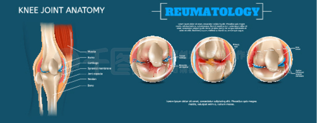 ĺͼϥؽڽʡ 3d ʸ Reumatology ͼԪؽṹϥؽڼ⡢ҡǡĤؽҡ졢