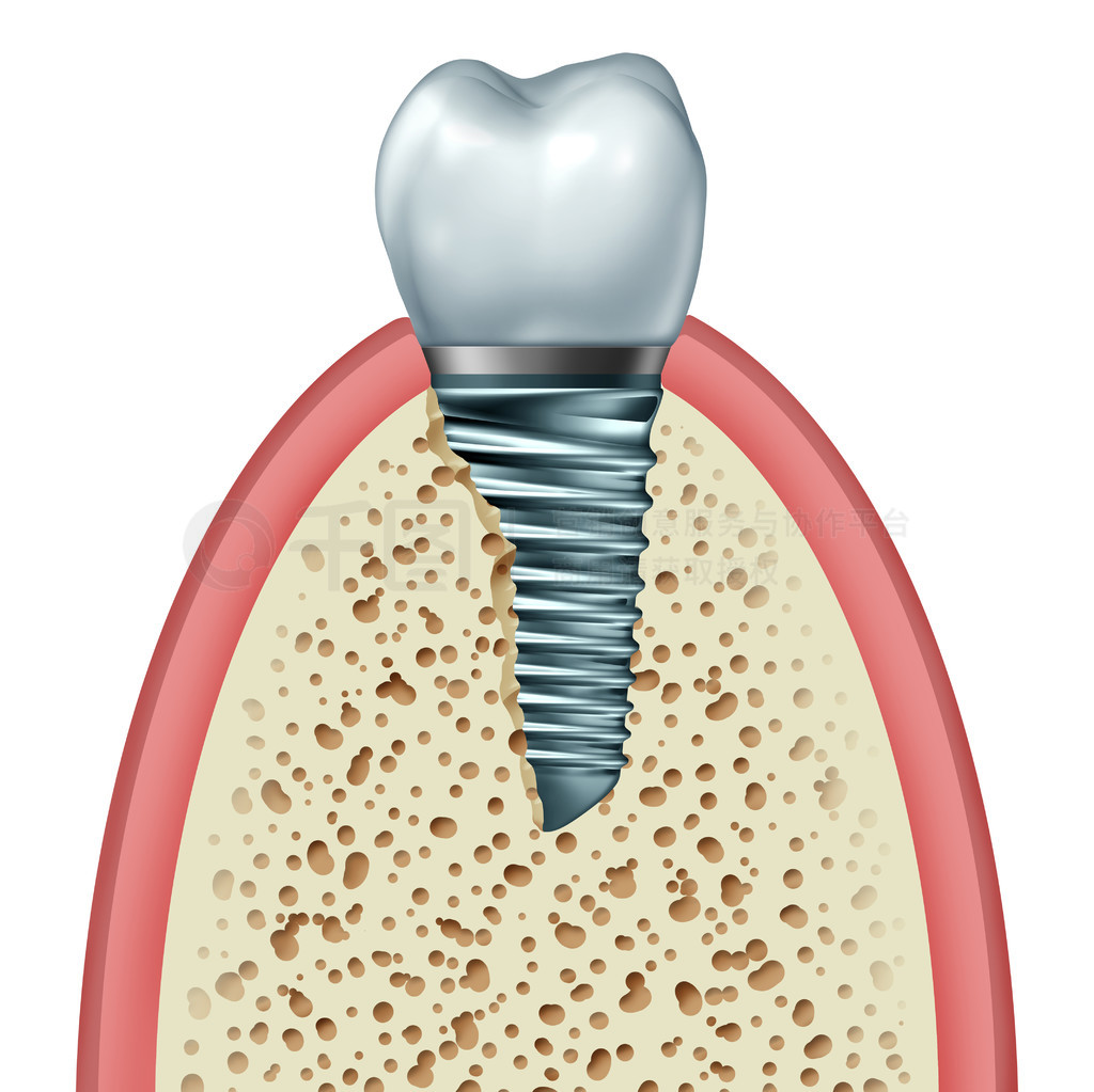 Ǻ֯ڵֲ޸ڻ̨ͽݶڰɫϸ룬ΪΪ 3D ͼ