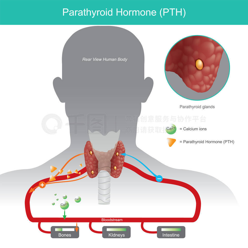 ״ټ(Parathyroid hormone,PTH)ˮƽϵʱ,ͨӸƺѪҺеĸƺ.˵1