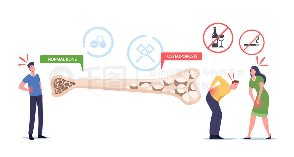 Osteoporosis, Symptoms, Health Care Concept. Tiny Male and Female Characters with Bones Disease near