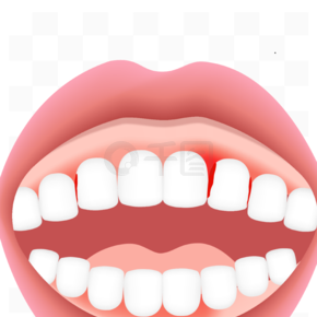 牙龈出血医疗口腔科牙齿嘴巴牙科医学健康