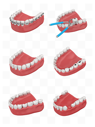 三维写实牙齿结<i>构</i>模型