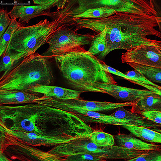 成纤维细胞显微镜图片