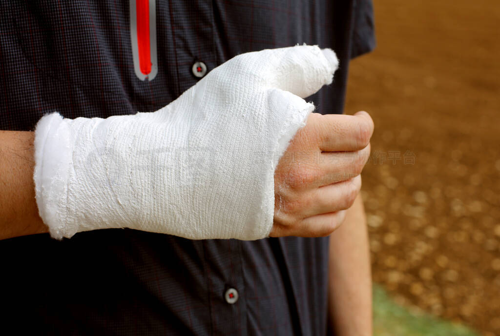 person with the thumb and wrist plastered after the fracture of