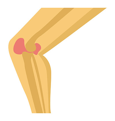 人体解剖显示膝关节疼痛, 平面图标设计