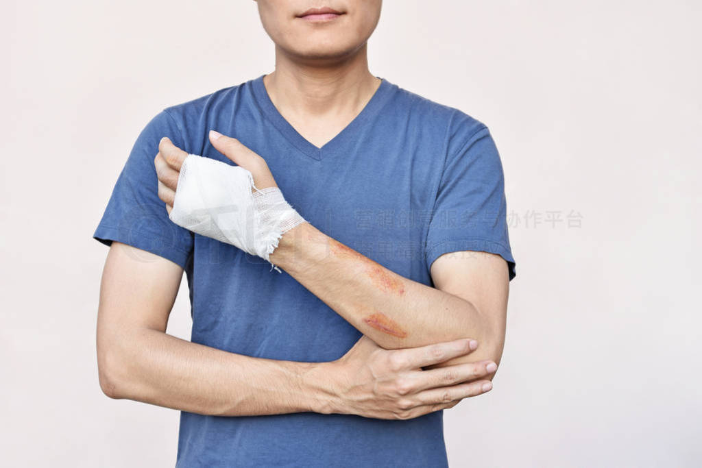 Man with hand in bandage after accident