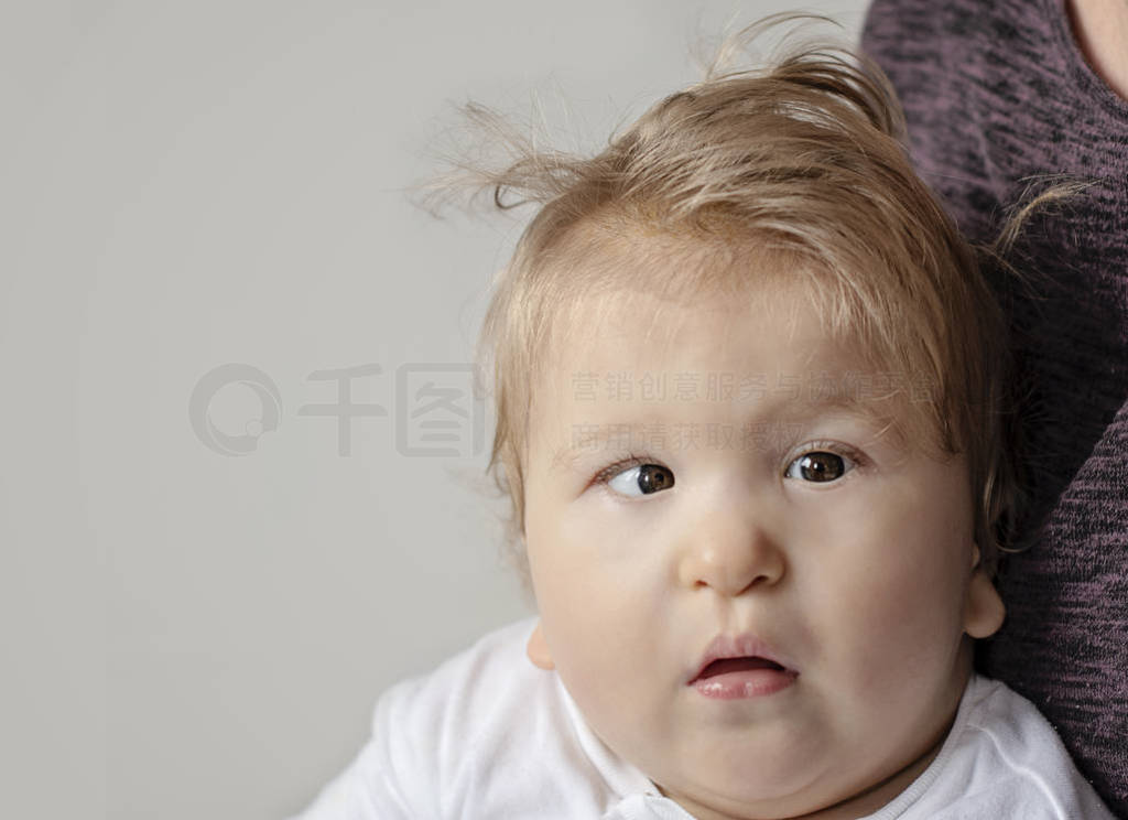 One year old disabled baby boy portrait. Special needs child.