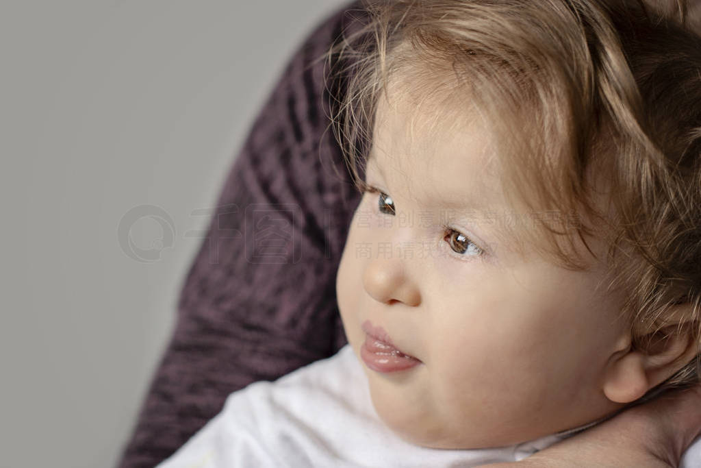 Close-up portrait of one year old disabled child