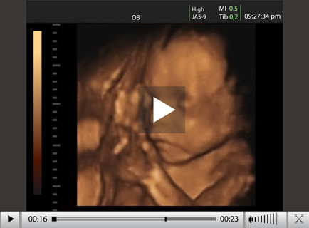 在母亲的子宫里的宝宝 4d 超声检查
