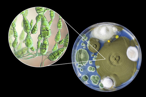 交替链格孢菌在营养培养基上的菌落图解和照片