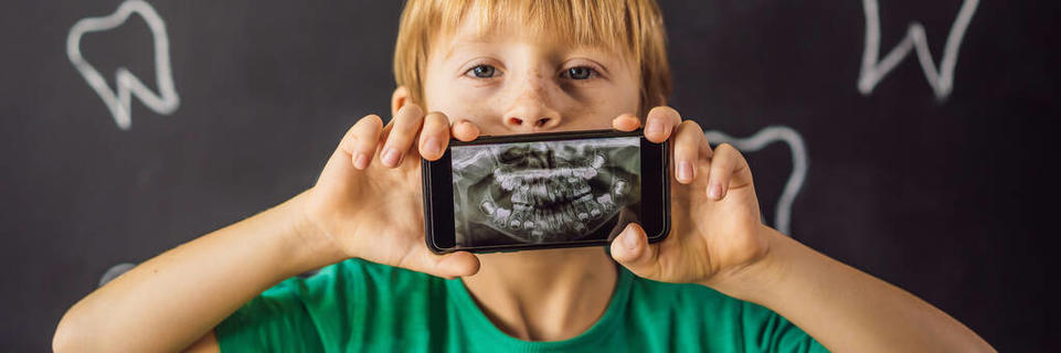 这个男孩展示了他牙齿的x光照片,上面有一颗异常奇怪的牙齿