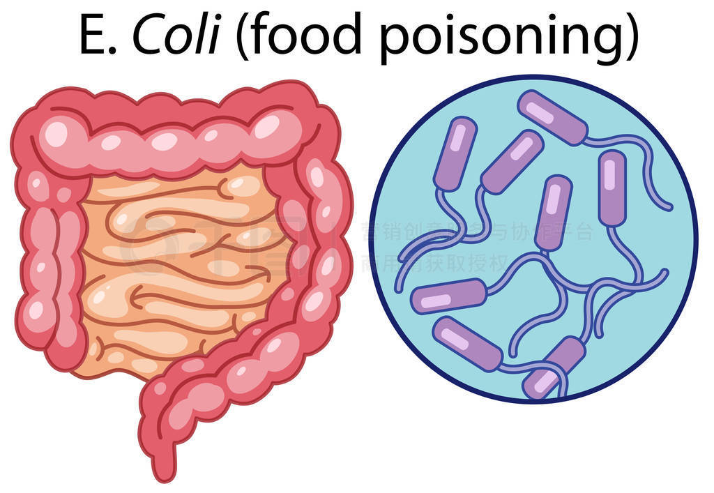 EColi(ʳж)