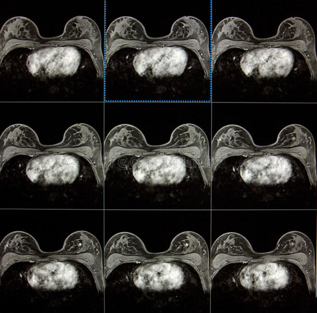 ٰmri