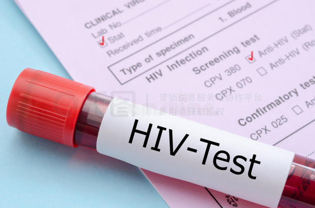 ɫԹϵHIV-Testǩ