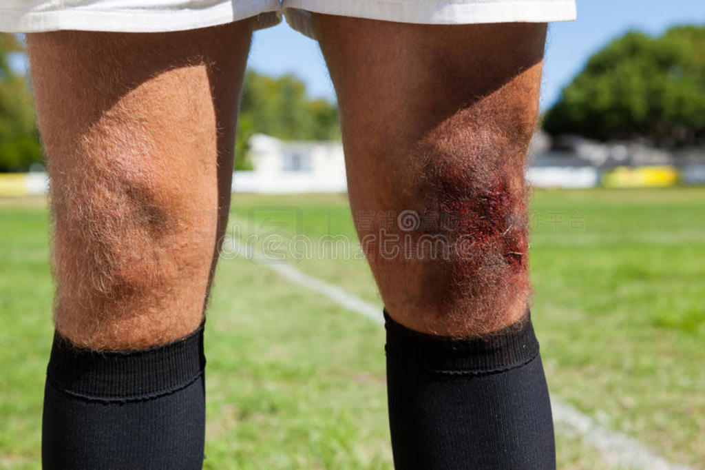 中间的部分关于橄榄球运动演员和受伤的膝起立在佩林