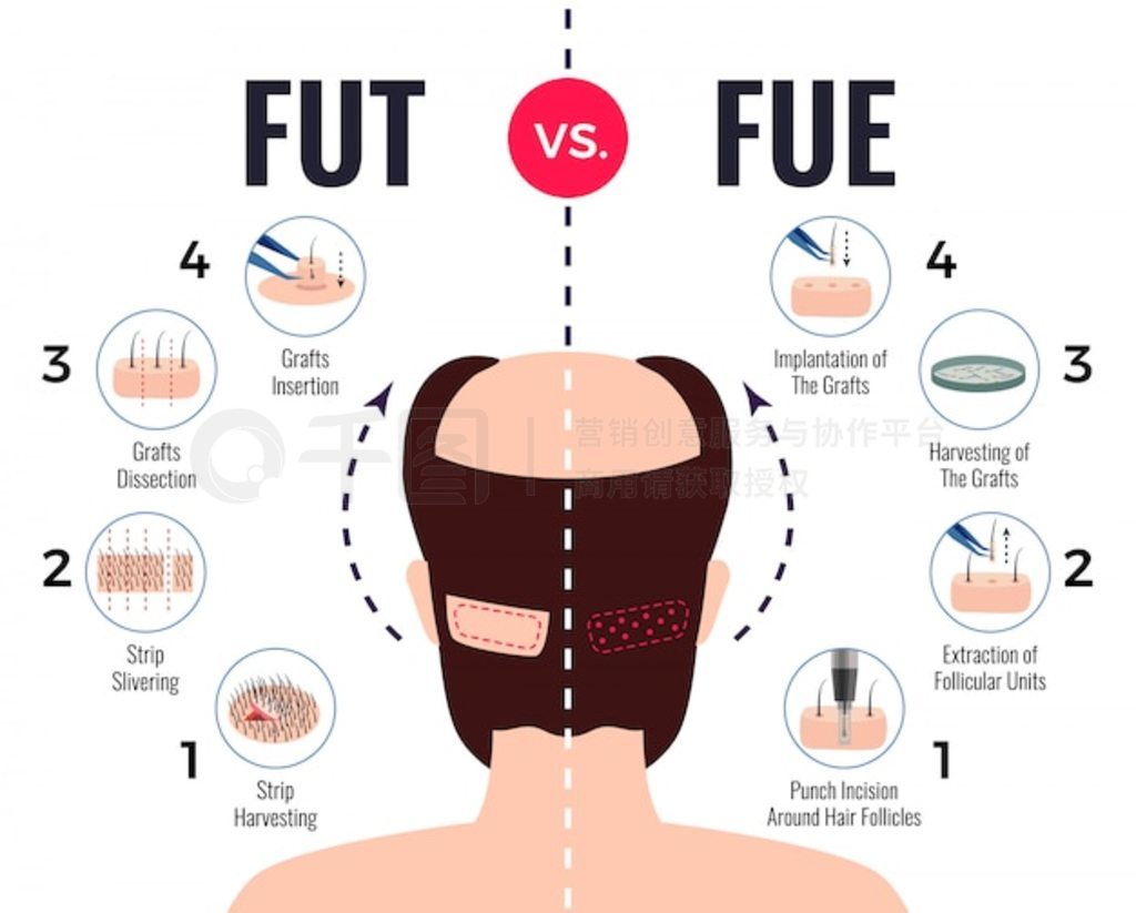 ëֲ fut vs fue ɫϢͼԪAI˹ͷ