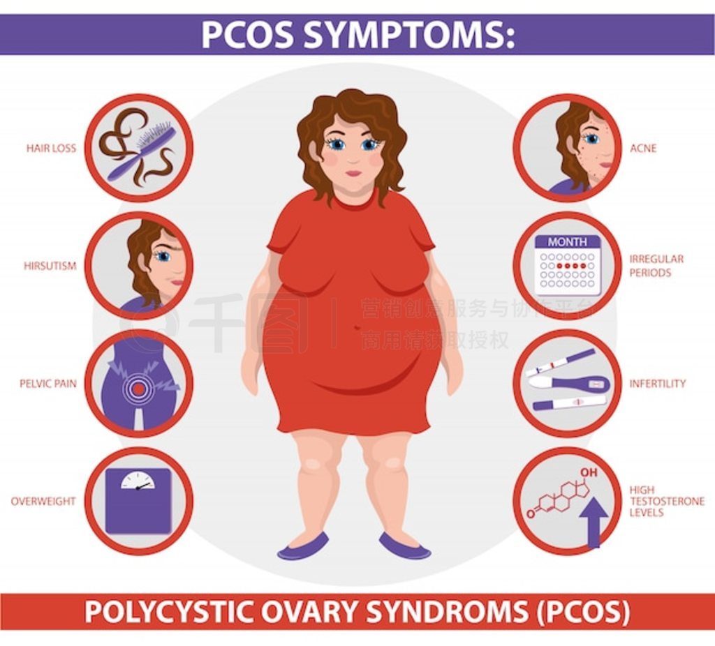 PCOS ֢״Ϣͼ