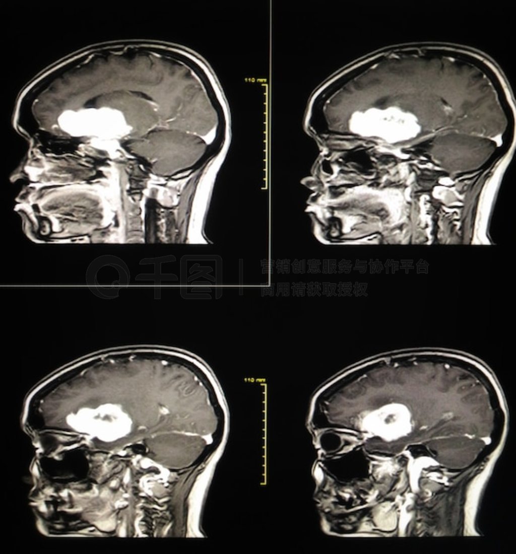 Բͼ MRI ׿顣