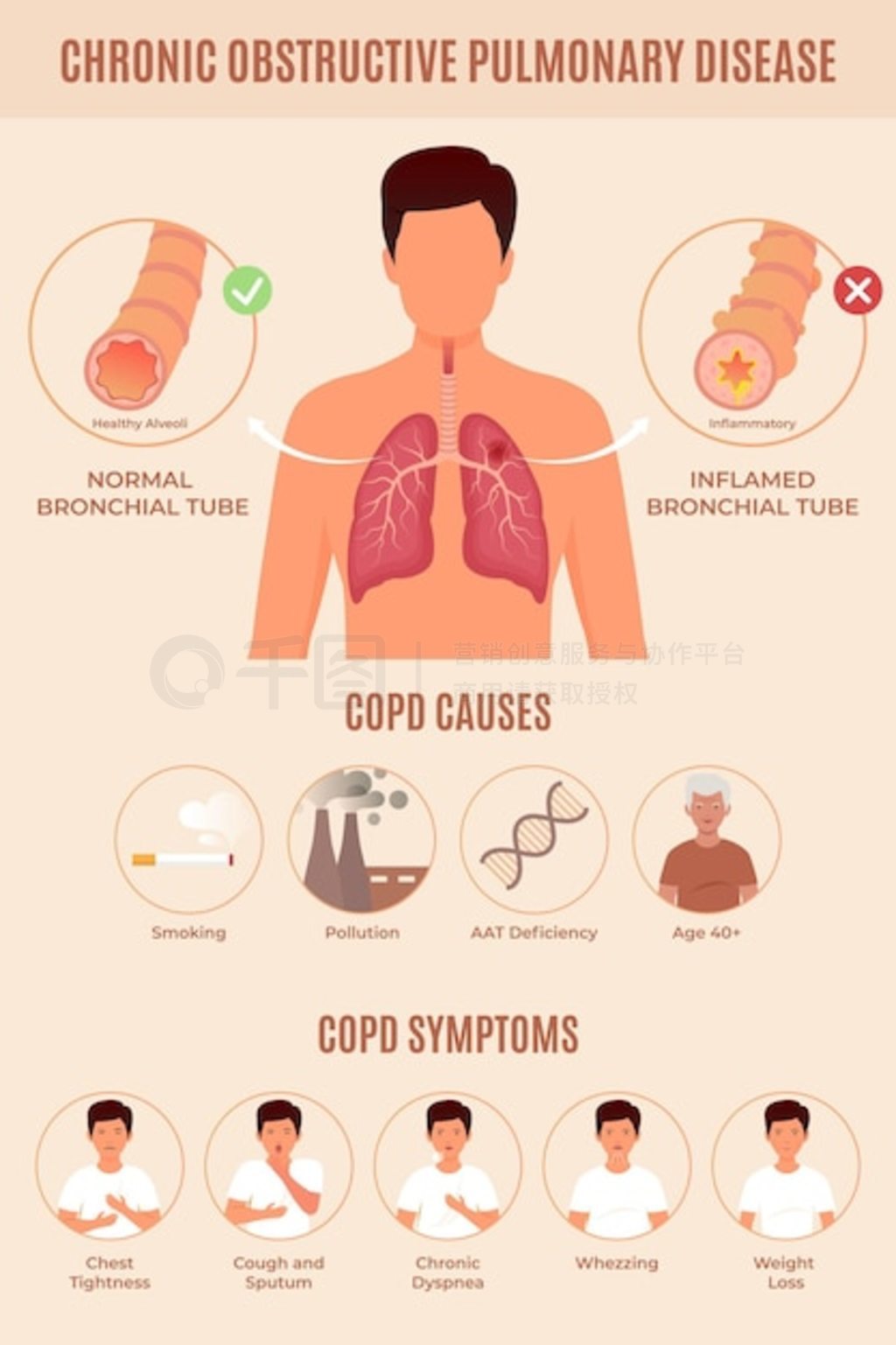 ƽֻ copd Ϣͼ