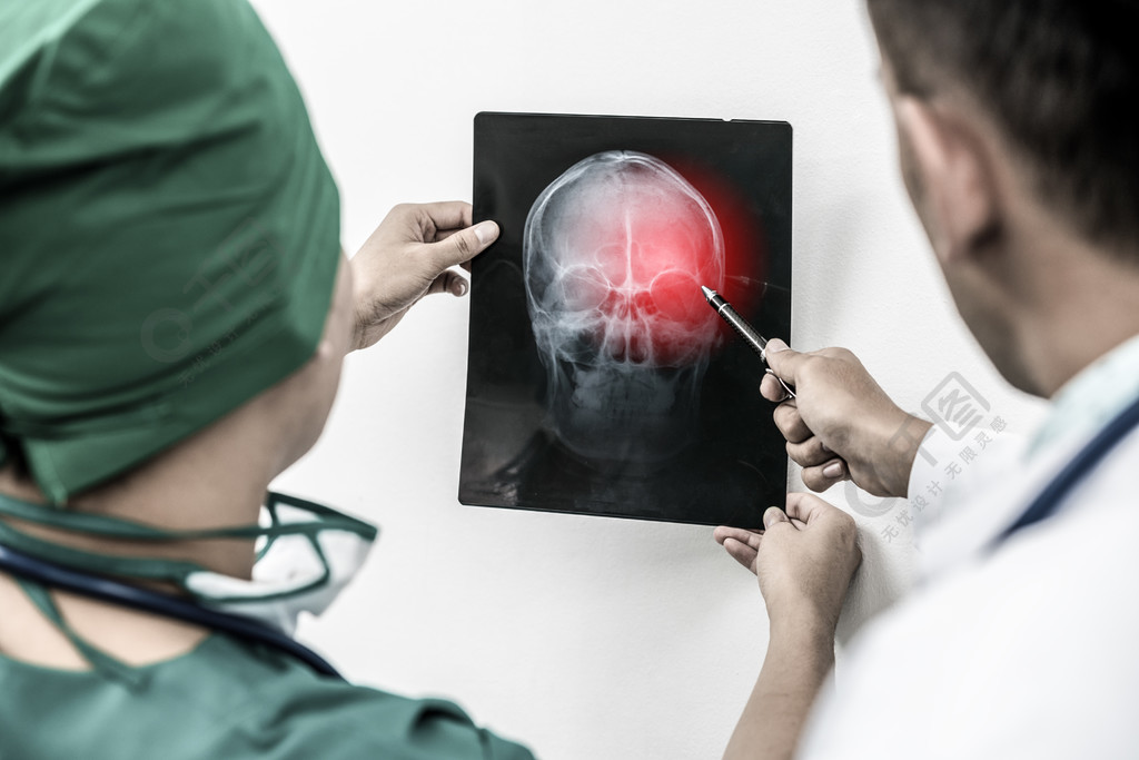 医生和外科医生正在检查患者头部的x光片是否有大脑颅骨或眼睛受伤