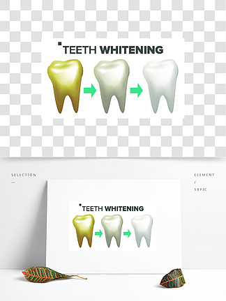 牙齿美白矢量牙和牙牙齿概念卫生保健现实的孤立的插图牙齿美白矢量牙齿美白前后牙科技师的概念孤立的插图