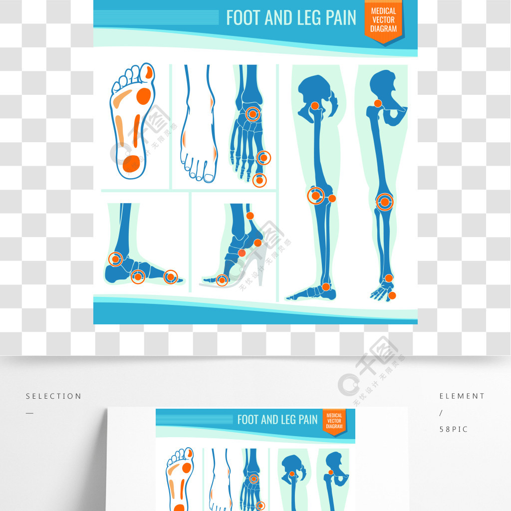 腳和腿疼痛關節炎和風溼病骨科醫學矢量圖風溼病腿關節的插圖腳和腿