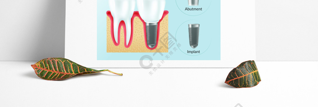與假牙的在健康牙冠基臺植入現實象附近導航例證現實的種植牙信息圖表