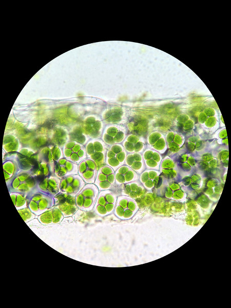 植物细胞的叶绿体在显微 i