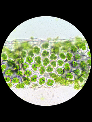 植物细胞的叶绿体在显微镜下