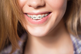 十几岁的<i>女</i>孩显示牙齿矫正的肖像.