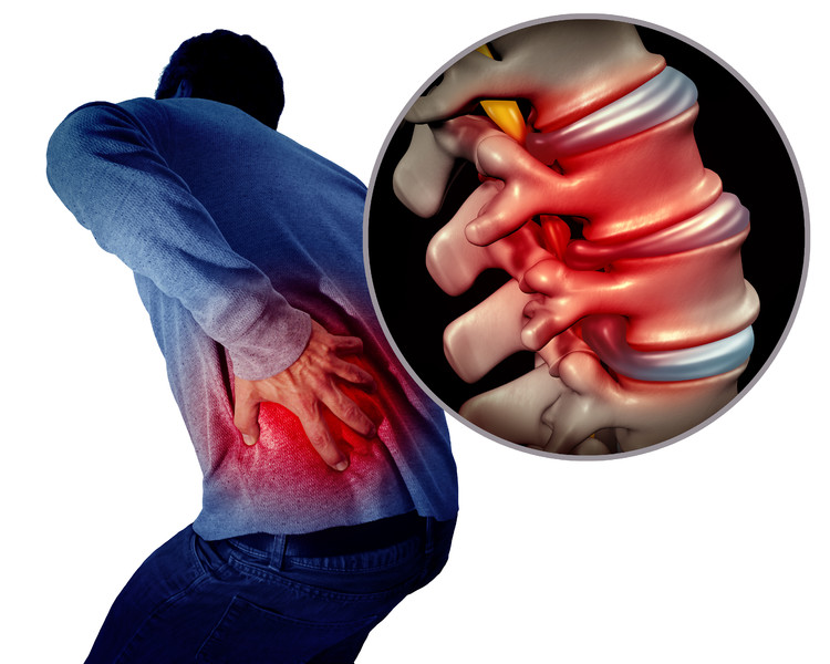 34440下背部疼痛或背痛和疼痛的脊椎医疗概念作为一个人持有疼痛的