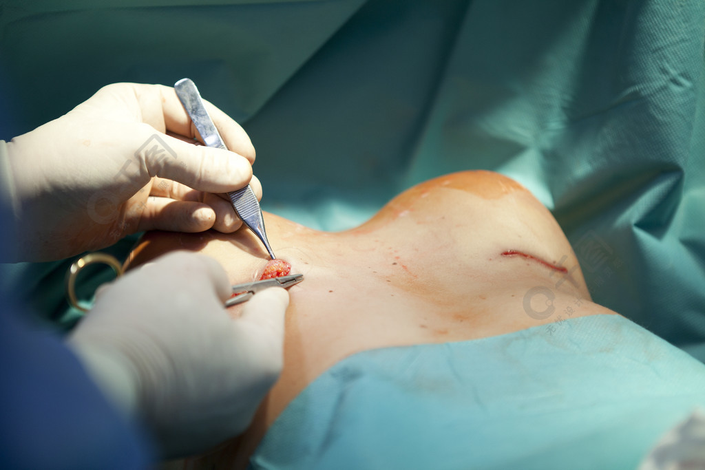在手术室外科医生工具隆胸手术植入