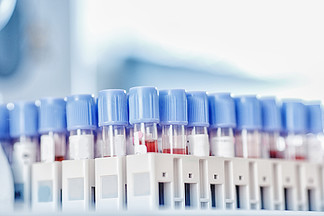 护士微生物学家拿着用于验血的验血试管对2019-<i>nCoV</i>进行分析