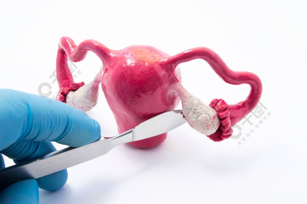 卵巢妇科手术概念手外科医生用手术刀附近女性生殖器的象征如癌症除