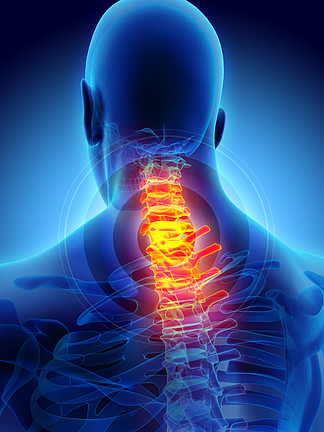 脖子痛-<i>宫</i><i>颈</i>脊柱骨骼 x 射线、 3d 图.