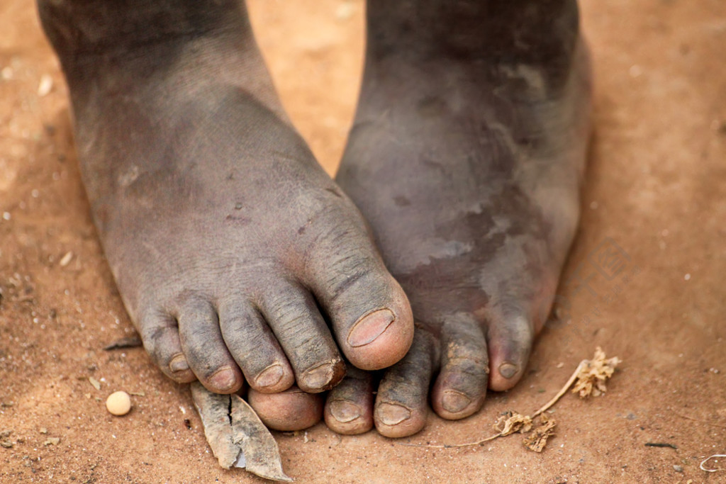 非洲儿童的脚人物形象免费下载