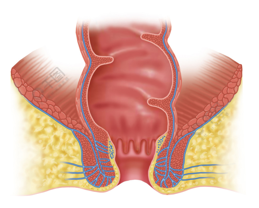 肛管减压图片