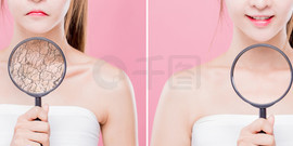 妇女采取放大颈部与干<i>性</i><i>皮</i>肤-保湿护理概念
