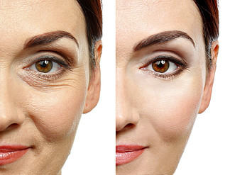 美容手术前后的妇女脸部整形外科概念