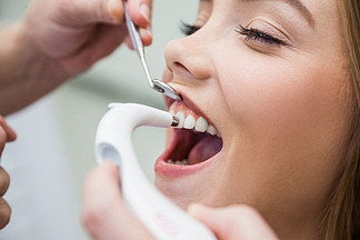 用牙科仪器对女性患者进行精确的牙齿颜色测<i>定</i>