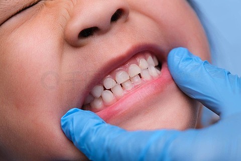 一个健康儿童口腔内的特写镜头,其乳牙一排排漂亮
